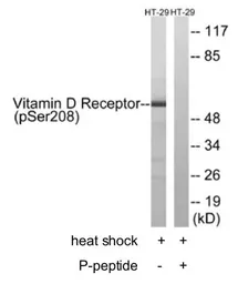 Anti-Vitamin D Receptor (phospho Ser208) antibody used in Western Blot (WB). GTX52380