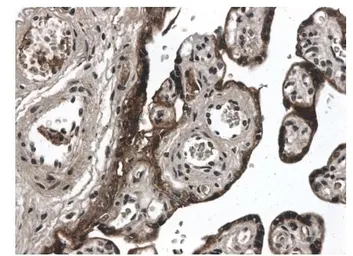 Anti-MMP12 antibody [7G20] used in IHC (Paraffin sections) (IHC-P). GTX52478