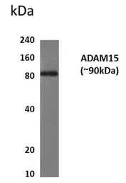 Anti-ADAM15 antibody [9H34] used in Western Blot (WB). GTX52529