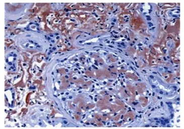 Anti-LECT2 antibody [4B24] used in Immunohistochemistry (IHC). GTX52904