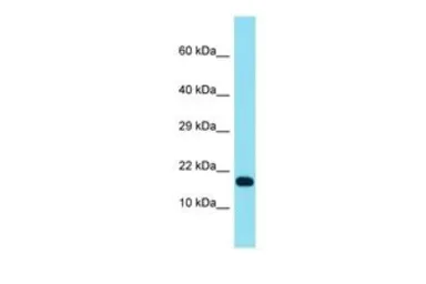 Anti-TCF21 antibody, N-term used in Western Blot (WB). GTX52981
