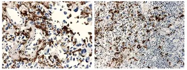 Anti-Macrophage antibody [11H3] used in IHC (Paraffin sections) (IHC-P). GTX53120