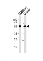 Anti-Casein Kinase I gamma 3 antibody used in Western Blot (WB). GTX53489