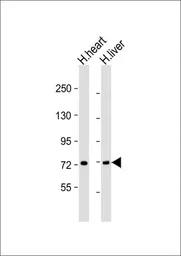 Anti-COL8A1 antibody used in Western Blot (WB). GTX53499