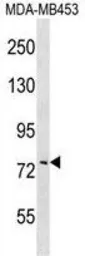 Anti-COL8A1 antibody used in Western Blot (WB). GTX53499