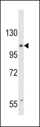 Anti-Cav alpha 2/delta 3 antibody used in Western Blot (WB). GTX53537