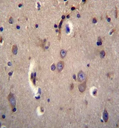 Anti-Dystrobrevin alpha antibody used in IHC (Paraffin sections) (IHC-P). GTX53551