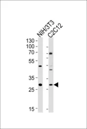 Anti-HOXC9 antibody used in Western Blot (WB). GTX53564