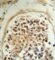 Anti-HCCA2 antibody used in IHC (Paraffin sections) (IHC-P). GTX53605