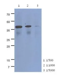 Anti-CRLF2 antibody [AT4E7] used in Western Blot (WB). GTX53705
