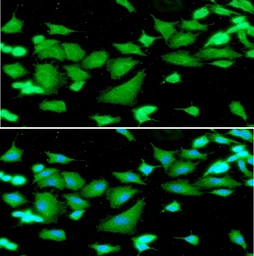 Anti-Cystatin B antibody [2F1] used in Immunocytochemistry/ Immunofluorescence (ICC/IF). GTX53707