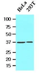 Anti-Laforin antibody [k2A3] used in Western Blot (WB). GTX53711