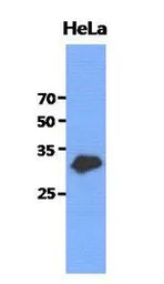 Anti-GCLM antibody [AT2D12] used in Western Blot (WB). GTX53719