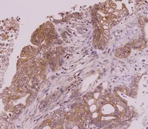 Anti-CLEC4E antibody [AT16E3] used in IHC (Paraffin sections) (IHC-P). GTX53742
