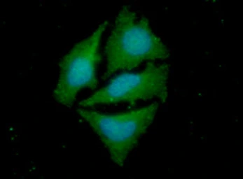 Anti-PPM1A antibody [p6c7] used in Immunocytochemistry/ Immunofluorescence (ICC/IF). GTX53766
