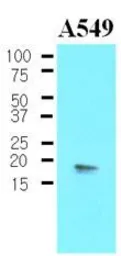 Anti-CPI-17 antibody [4H10] used in Western Blot (WB). GTX53770