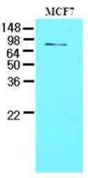 Anti-TDP1 antibody [AT1F2] used in Western Blot (WB). GTX53791