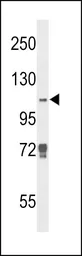 Anti-KDM4B antibody used in Western Blot (WB). GTX53804