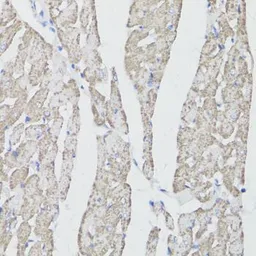 Anti-CD59 antibody used in IHC (Paraffin sections) (IHC-P). GTX53909
