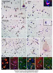 Anti-CD47 antibody used in IHC (Paraffin sections) (IHC-P). GTX53912
