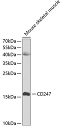 Anti-CD3 zeta antibody used in Western Blot (WB). GTX53919