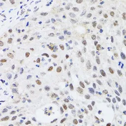 Anti-CBX4 antibody used in IHC (Paraffin sections) (IHC-P). GTX53928