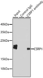 Anti-CSRP1 antibody used in Immunoprecipitation (IP). GTX53932