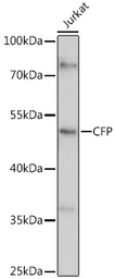 Anti-Properdin antibody used in Western Blot (WB). GTX53957
