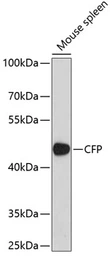 Anti-Properdin antibody used in Western Blot (WB). GTX53957