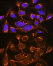 Anti-Properdin antibody used in Immunocytochemistry/ Immunofluorescence (ICC/IF). GTX53957