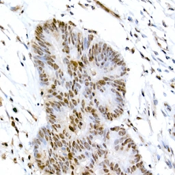 Anti-CREB (phospho Ser133) antibody used in IHC (Paraffin sections) (IHC-P). GTX53975