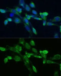Anti-FDFT1 antibody used in Immunocytochemistry/ Immunofluorescence (ICC/IF). GTX53976