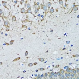 Anti-FDFT1 antibody used in IHC (Paraffin sections) (IHC-P). GTX53976