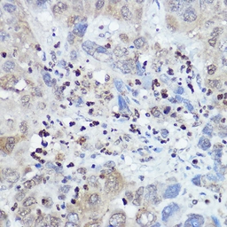 Anti-FANCC antibody used in IHC (Paraffin sections) (IHC-P). GTX53977
