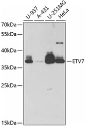 Anti-ETV7 antibody used in Western Blot (WB). GTX53979