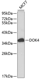 Anti-DOK4 antibody used in Western Blot (WB). GTX53984