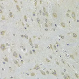 Anti-DHRS9 antibody used in IHC (Paraffin sections) (IHC-P). GTX54001