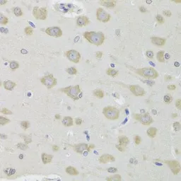 Anti-DHRS9 antibody used in IHC (Paraffin sections) (IHC-P). GTX54001