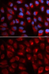Anti-EPB41 antibody used in Immunocytochemistry/ Immunofluorescence (ICC/IF). GTX54005