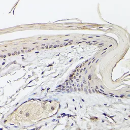 Anti-PEA3 antibody used in IHC (Paraffin sections) (IHC-P). GTX54006