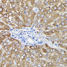 Anti-Ferritin Heavy Chain antibody used in IHC (Paraffin sections) (IHC-P). GTX54014