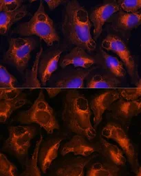 Anti-Fibrinogen gamma antibody used in Immunocytochemistry/ Immunofluorescence (ICC/IF). GTX54026