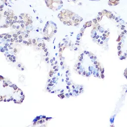 Anti-DDX3 antibody used in IHC (Paraffin sections) (IHC-P). GTX54030