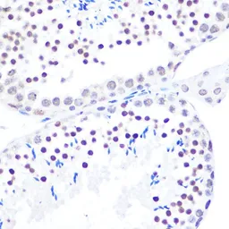 Anti-DDX3 antibody used in IHC (Paraffin sections) (IHC-P). GTX54030