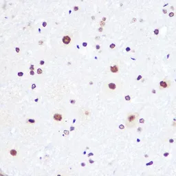 Anti-DDX3 antibody used in IHC (Paraffin sections) (IHC-P). GTX54030