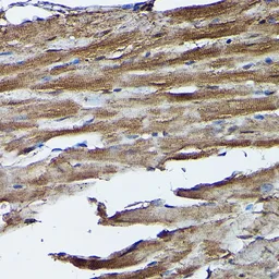Anti-Frataxin antibody used in IHC (Paraffin sections) (IHC-P). GTX54036