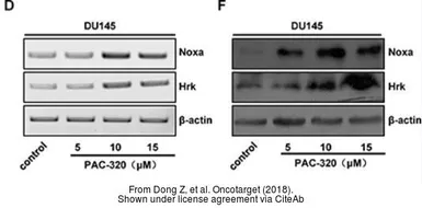 Anti-Hrk antibody used in Western Blot (WB). GTX54049