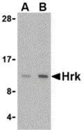 Anti-Hrk antibody used in Western Blot (WB). GTX54049