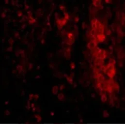 Anti-IL33 (pro) antibody used in IHC (Paraffin sections) (IHC-P). GTX54067