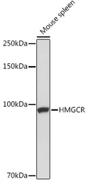 Anti-HMGCR antibody used in Western Blot (WB). GTX54088